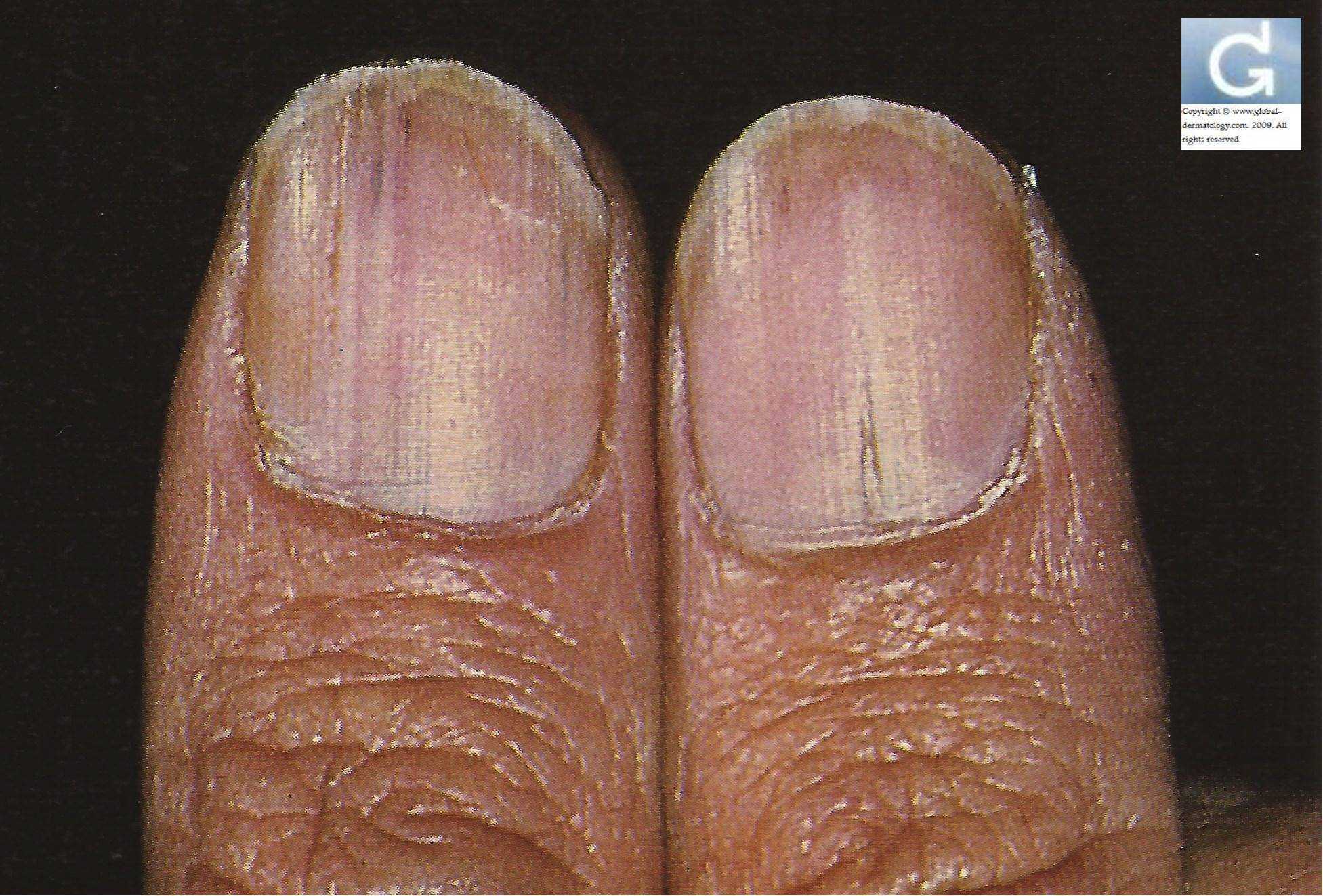 Каким должен быть маникюр на короткие и широкие ногти? особенности наращивания и фото вариантов