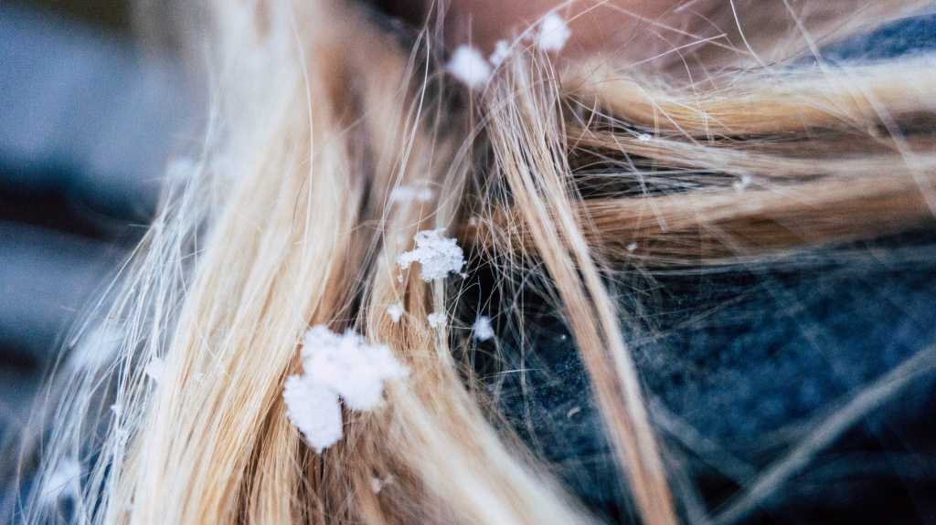 Как восстановить красоту волос после зимы за 5 шагов