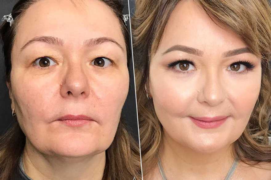 Как подтянуть овал лица после 40, 45 и 50 лет