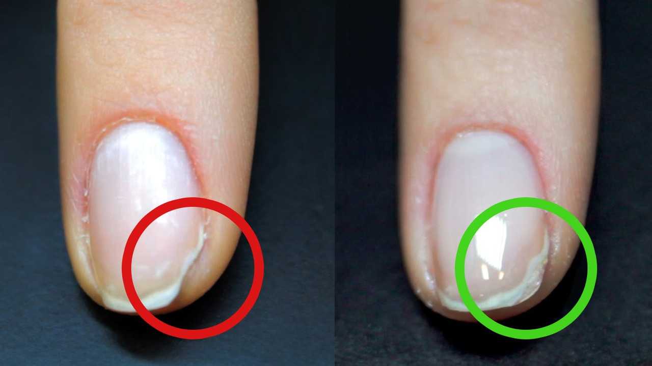 Почему трескается гель лак на нарощенных, натуральных, тонких ногтях и на кончиках? что делать, если потрескался гель лак на ногтях?