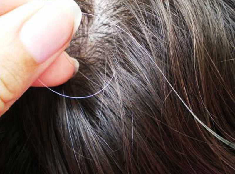 Преждевременное поседение волос: выясняем причины и принимаем меры
