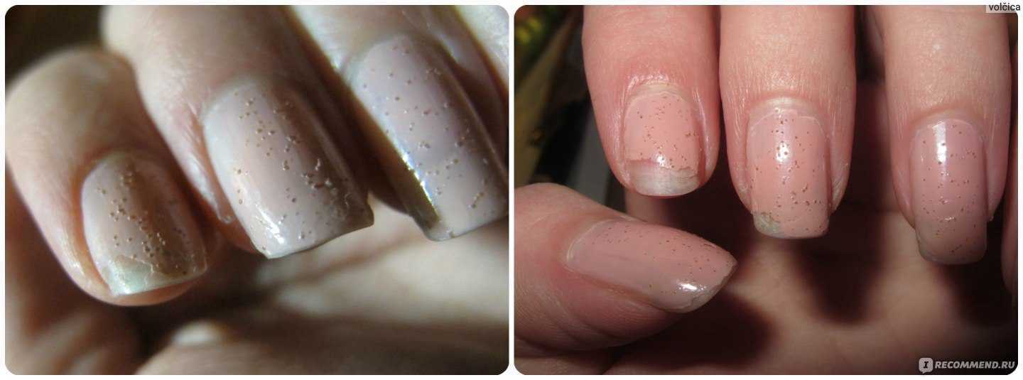 Почему лак на ногтях пузырится, и чем его можно разбавить?