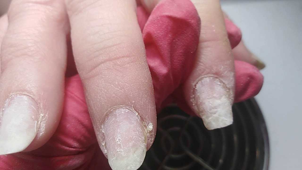 Почему трескается гель-лак на ногтях – причины и решение проблем