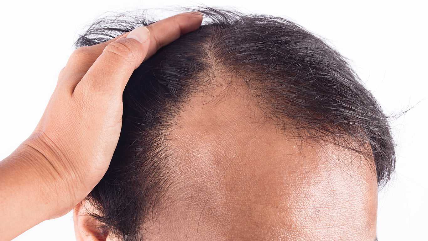 Какому доктору обратиться если выпадают волосы на голове у женщин