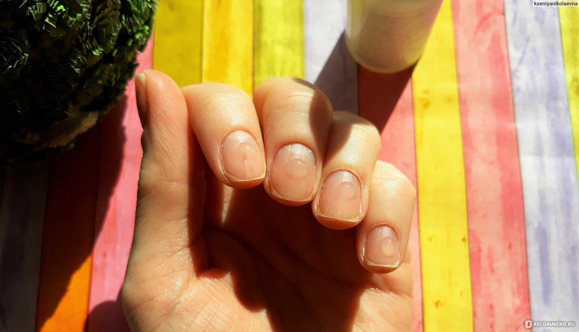 Почему гель-лак мягкий на ногтях. почему гель-лак не держится на ногтях, причины и их устранение | красивые прически
