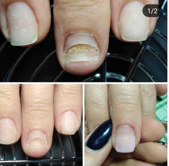 Почему пузырится лак на ногтях после нанесения