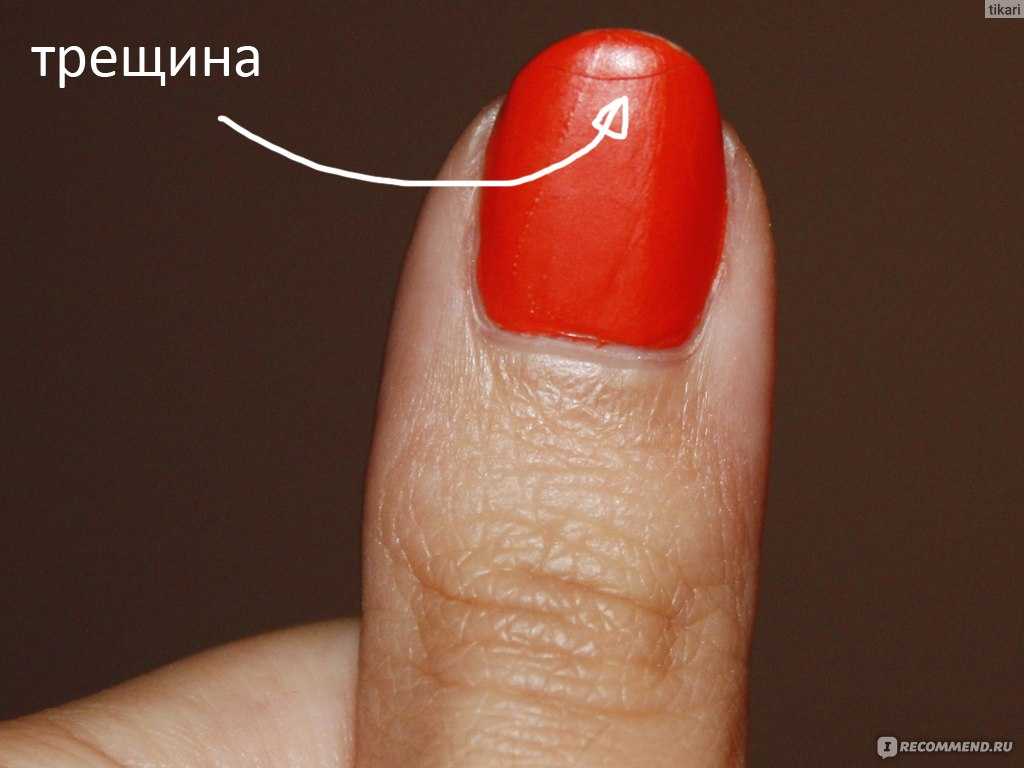 Почему не держится гель лак на ногтях: причины, идеи, советы
почему не держится гель лак на ногтях — modnayadama