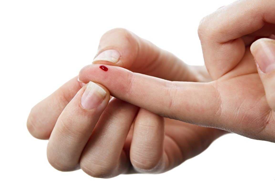К чему порезать палец на правой или левой руке
