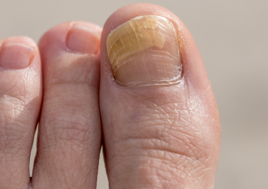 Маникюр на обгрызанные ногти, как восстановить ногти в домашних условиях