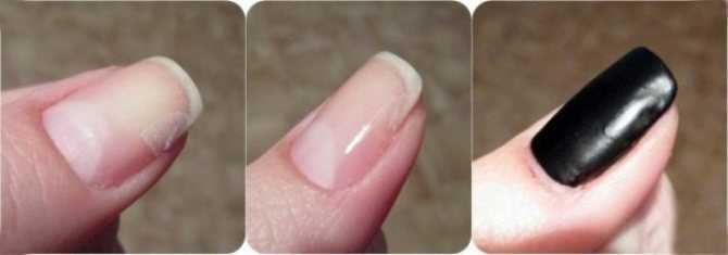 Почему пузырится лак на ногтях: что делать, как убрать и как избежать? как выбрать хороший лак для ногтей?
