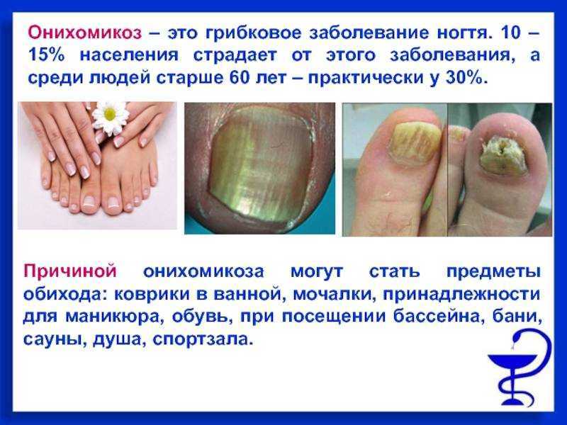 Потемнение кожных покровов
