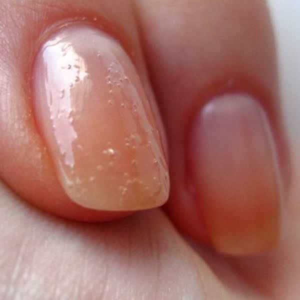 Почему пузырится лак на ногтях, после нанесения: вздулся гель после сушки, топовое покрытие и шеллак на следующий день