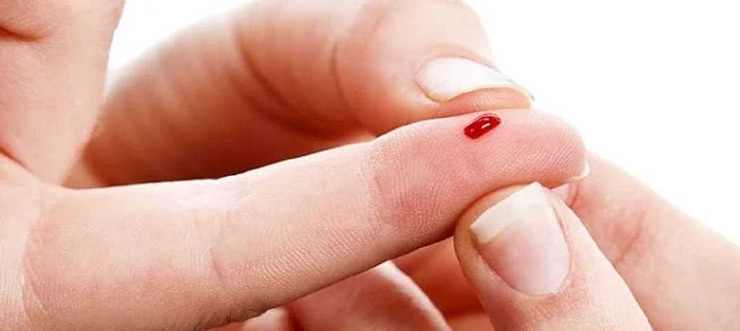 Примета "уколоть палец иголкой": значение и суеверия, расшифровка, чего ожидать